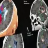 Screenshot: Detailed visualizations in Cranial Navigation