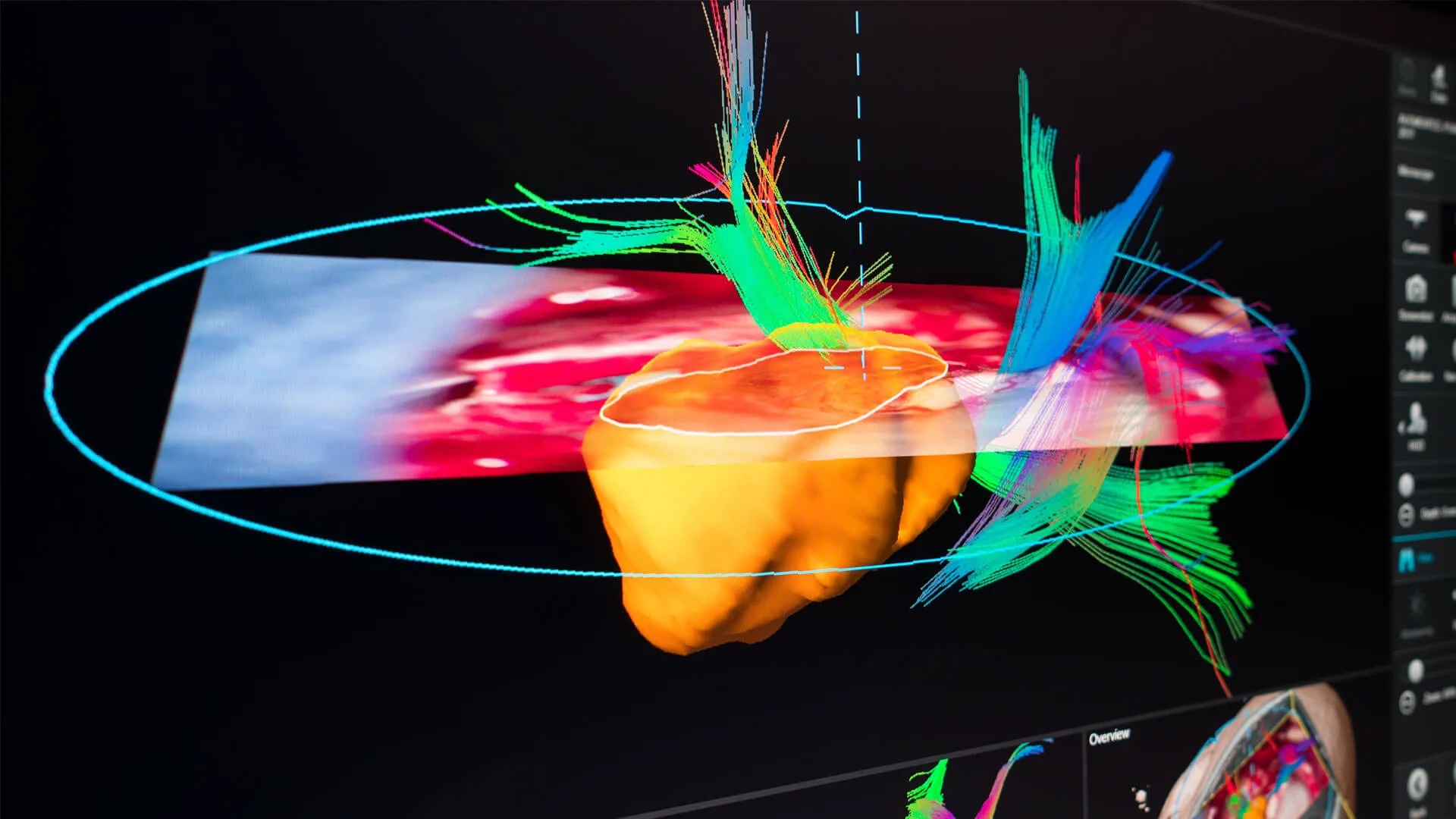 Augmented Reality Visualization through Microscope Navigation