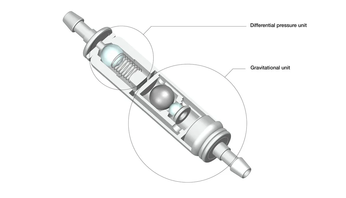 GAV Pressure Stages X-Ray Example