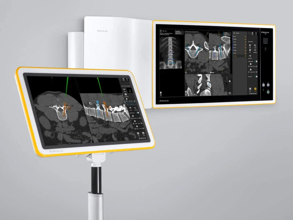 Kick® Enhanced by Buzz Digital O.R. for Advanced Surgical Planning