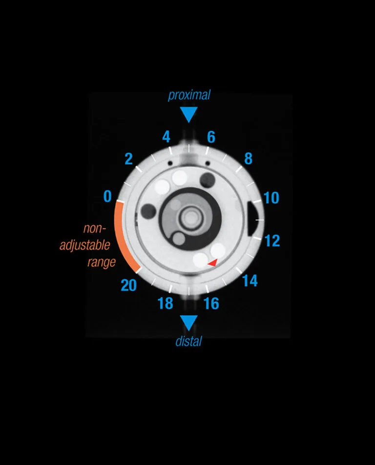 proGAV 2.0 Pressure Level X-ray