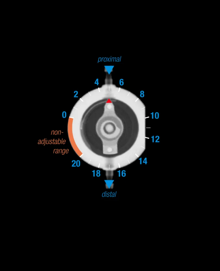 proGAV Pressure Level X-ray