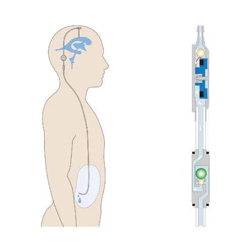 proGAV Vertical Position Illustration