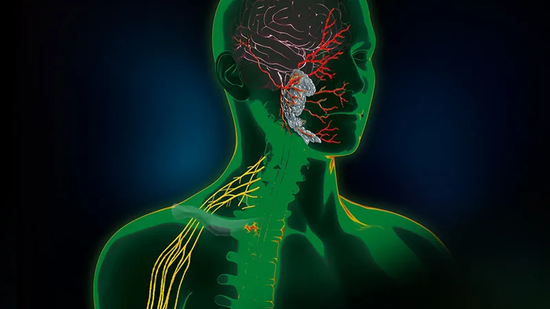 Direct Nerve Stimulation